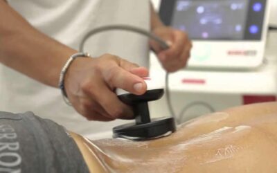 LA TECARTERAPIA: UNA PANORAMICA APPROFONDITASUI BENEFICI E APPLICAZIONI